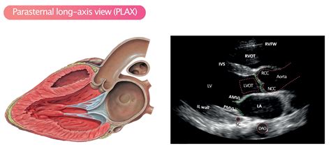 Standard Transthoracic Echocardiogram: Complete Imaging 